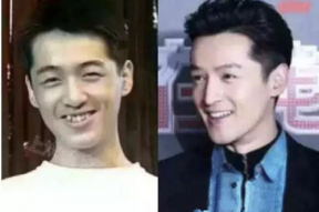 胡歌整容前照片,揭秘胡歌整容前后的惊人蜕变
