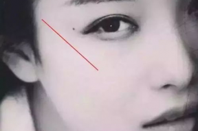 有泪痣明星,命运之痣下的璀璨星光