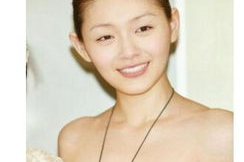 颧骨宽照片,颧骨宽照片解析与改善建议